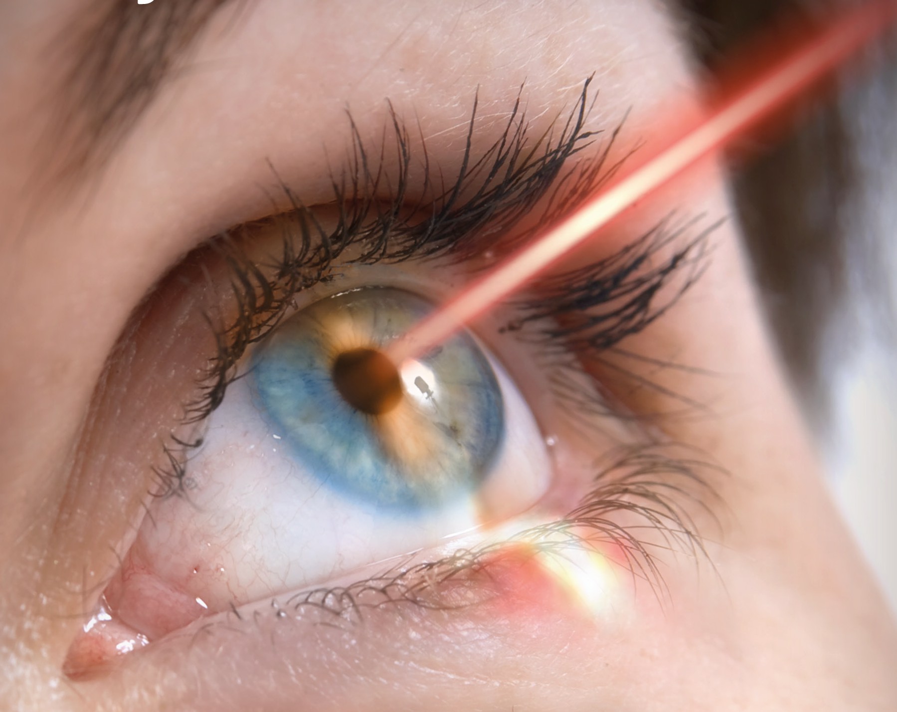 We Reveal To You What Laser Eye Surgery Is Really Like Three Most 